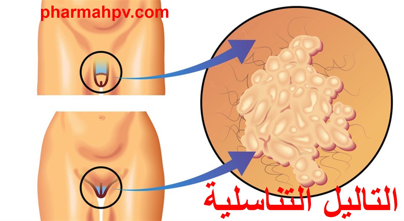 التاليل التناسلية